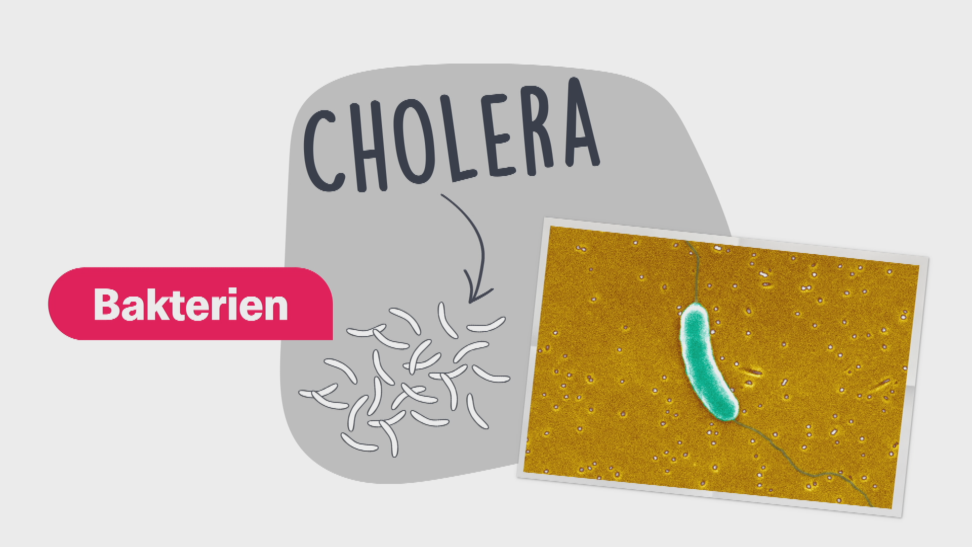 Cholera