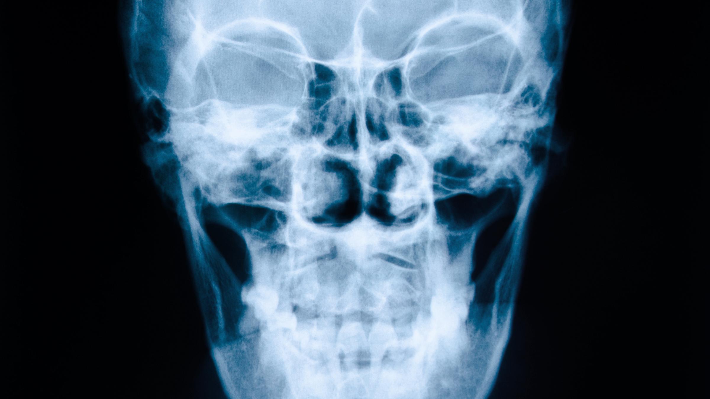 Entdeckung der Röntgenstrahlung