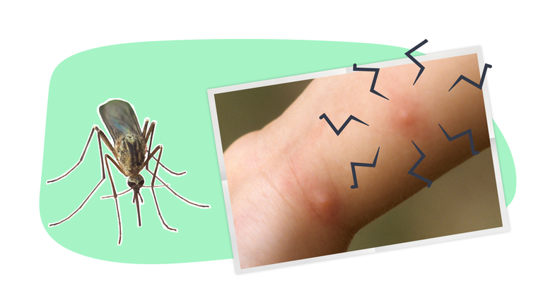 Erklärgrafik Mückenstich