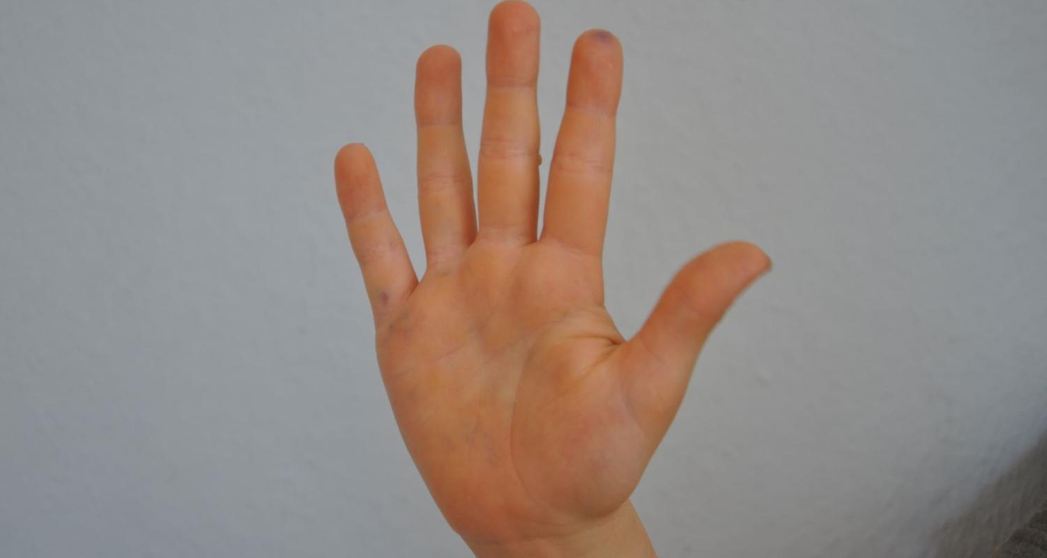 Kinderhand