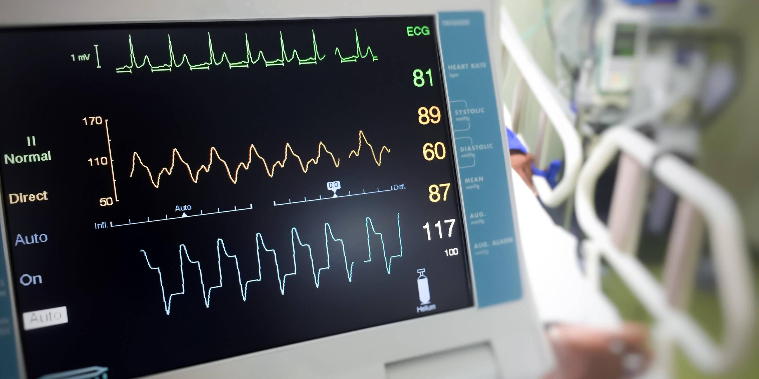 Ein EKG Monitor