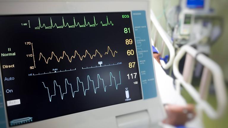 Ein EKG Monitor
