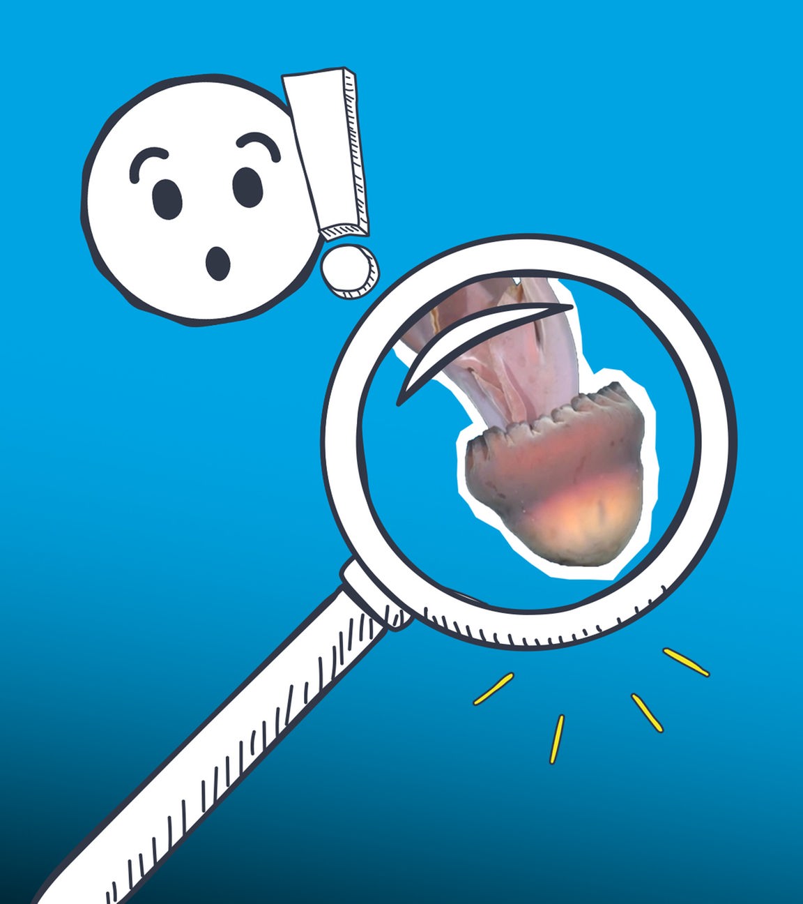 Riesenqualle entdeckt