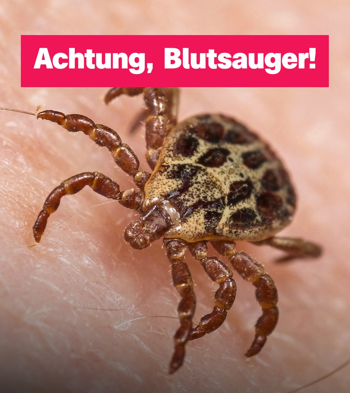 Eine Zecke auf der Haut.
