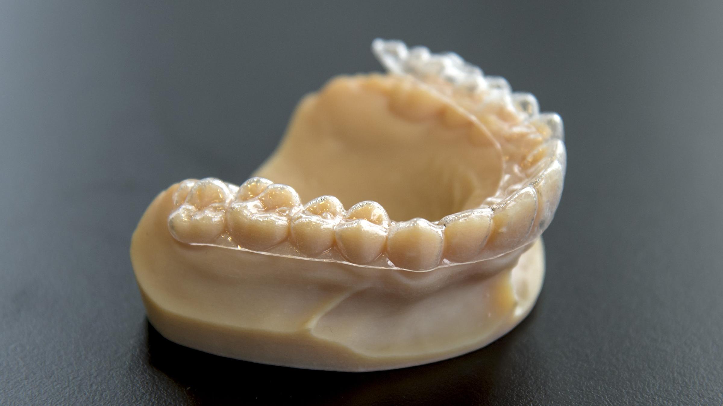Eine Zahnschiene liegt auf einem Gebiss