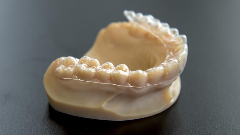 Eine Zahnschiene liegt auf einem Gebiss