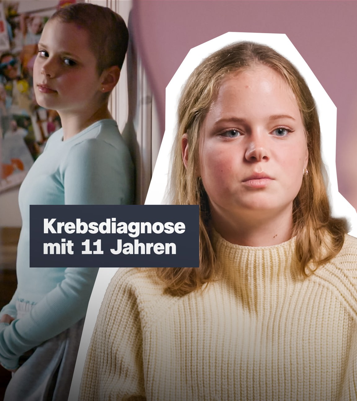 Ein blondes Mädchen im Vordergrund, im Hintergrund ein Bild von dem Mädchen früher mit Glatze