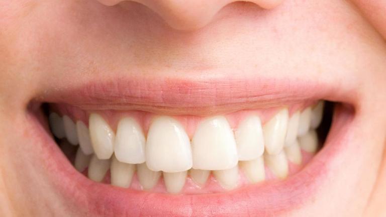 Zähne einer jungen Frau