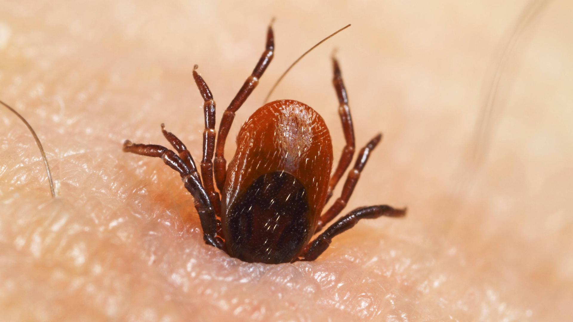 Nahaufnahme: Zecke steckt in der Haut